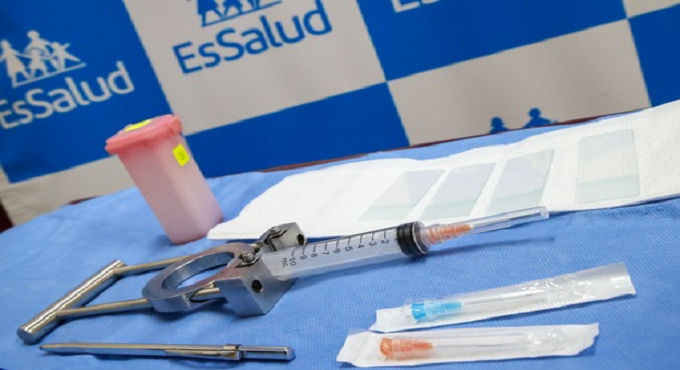 EsSalud: Hospital Rebagliati realiza innovador procedimiento para determinar si un paciente tiene o no cáncer