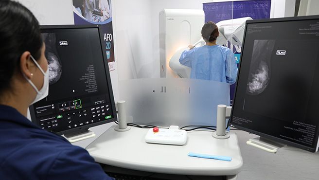 Peruanas contarán con 29 mamógrafos para descarte de cáncer de mama en Lima y regiones