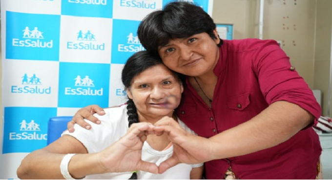 Hospital Almenara: con tejido de su antebrazo reconstruyen rostro de sexagenaria