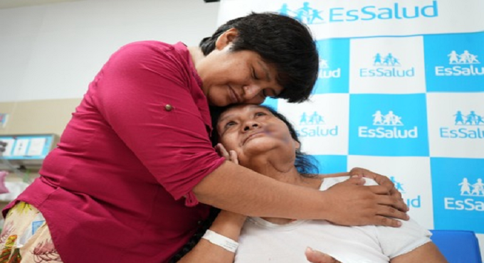 Hospital Almenara: con tejido de su antebrazo reconstruyen rostro de sexagenaria