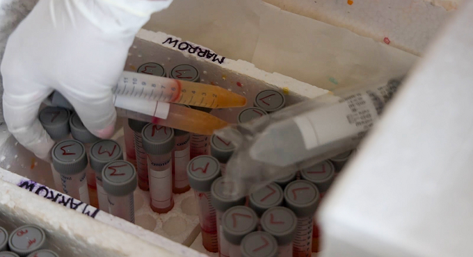 EsSalud: Más de 258 mil consultas de enfermedades raras y huérfanas fueron atendidas de manera oportuna.