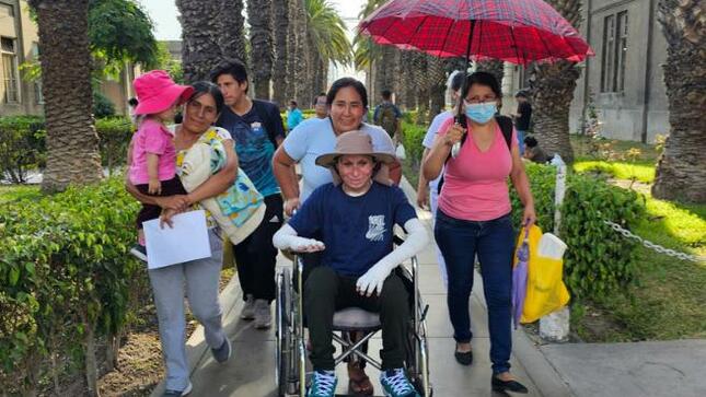 Minsa: especialistas del hospital Loayza salvan la vida de joven que sufrió quemaduras graves en el 75 % de su cuerpo 