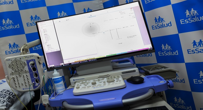 EsSalud: Hospital Rebagliati adquiere equipo de última generación para diagnóstico de enfermedades nerviosas