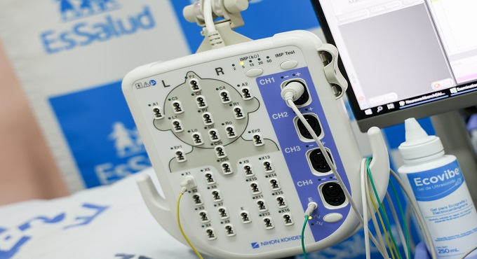 EsSalud: Hospital Rebagliati adquiere equipo de última generación para diagnóstico de enfermedades nerviosas
