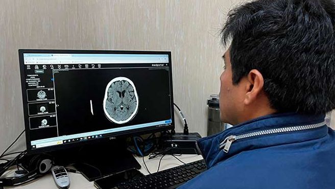 Resultados de exámenes radiológicos podrán ser visualizados por pacientes desde su hogar