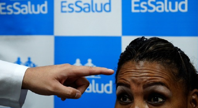 EsSalud alerta: Qué hacer ante un infarto cerebral