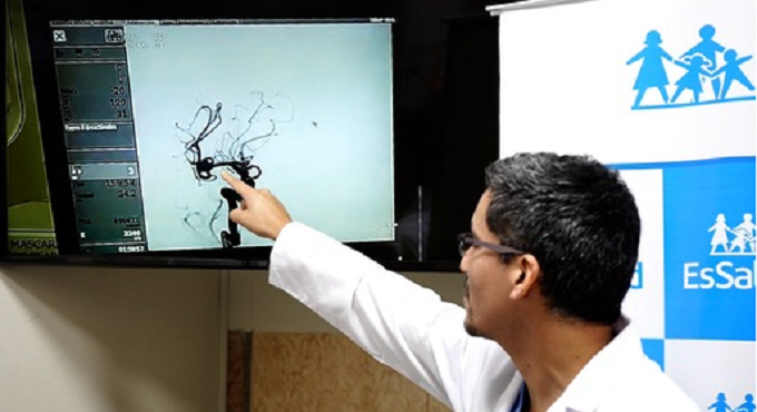 EsSalud alerta: Qué hacer ante un infarto cerebral
