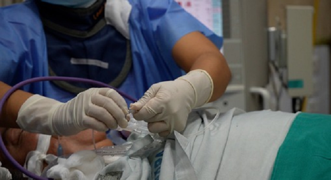 EsSalud alerta: Qué hacer ante un infarto cerebral