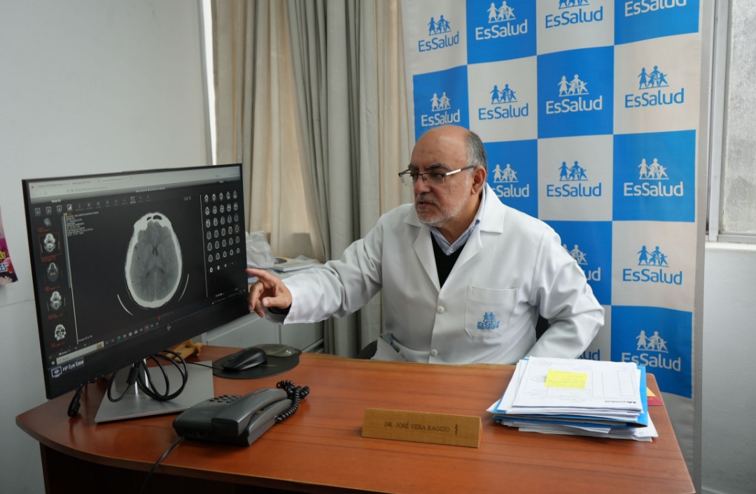EsSalud: Mujeres Menores de 50 años pueden padecer miastenia gravis sin saberlo