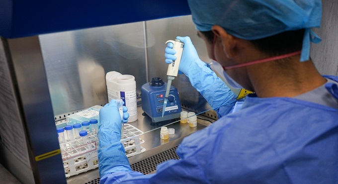 Hospital Sabogal de EsSalud adquiere 1500 pruebas rápidas para detección de TBC