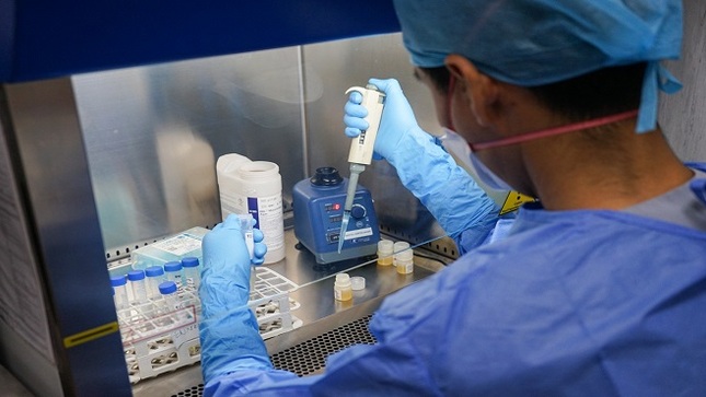 Hospital Sabogal de EsSalud adquiere 1500 pruebas rápidas para detección de TBC
