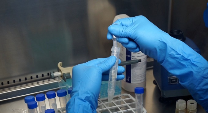 Hospital Sabogal de EsSalud adquiere 1500 pruebas rápidas para detección de TBC