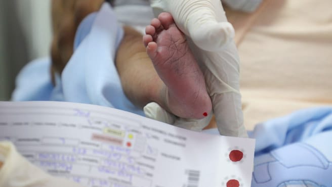 Pruebas de tamizaje neonatal alcanzaron el 85 % de cobertura a nivel nacional