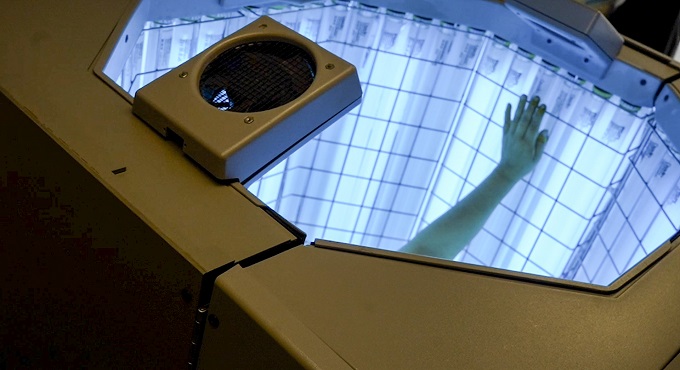 Hospital Almenara de EsSalud brindó tratamiento de fototerapia a más de 500 pacientes con vitíligo