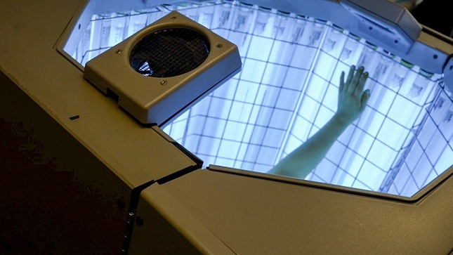 Hospital Almenara de EsSalud brindó tratamiento de fototerapia a más de 500 pacientes con vitíligo