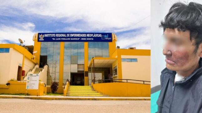 Telemedicina permite salvarle la vida a paciente de 38 años que padecía de un sarcoma de alto grado