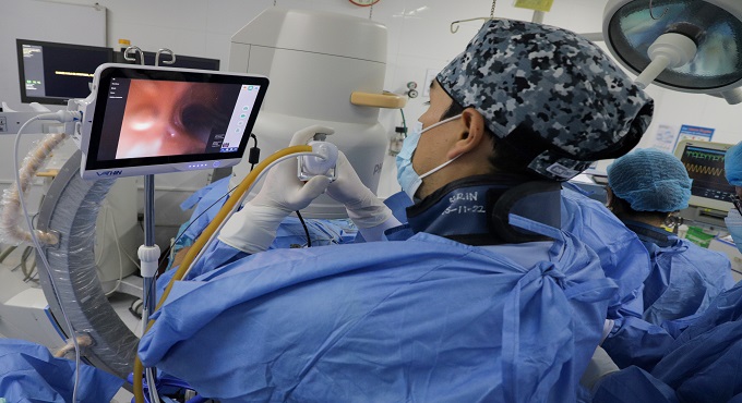EsSalud: Hospital Rebagliati realiza con éxito nuevo procedimiento no invasivo para detectar fibrosis pulmonar