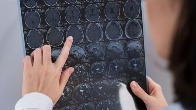 Profesionales peruanos podrán llevar curso sobre medicina regenerativa aplicada a la neurología que ofrece CABBIO (Brasil)