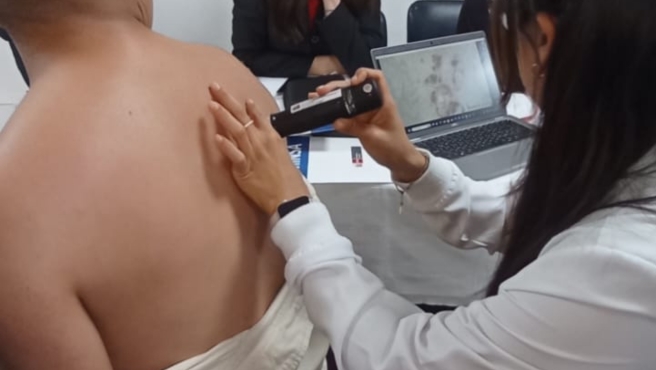 Fortalecen capacidades en detección temprana de cáncer de piel en médicos de establecimientos de salud de la DIRIS Lima Sur