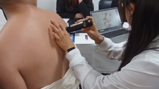 Fortalecen capacidades en detección temprana de cáncer de piel en médicos de establecimientos de salud de la DIRIS Lima Sur