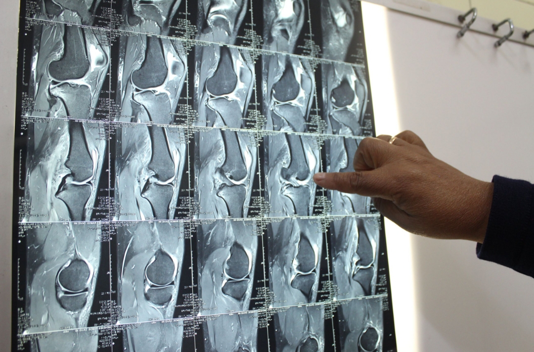 EsSalud realizó más de 26 mil cirugías traumatológicas en lo que va del 2024