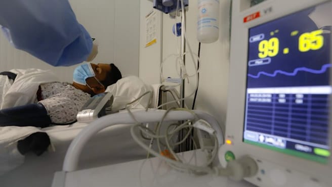 Minsa emite alerta epidemiológica en prevención a nuevo linaje de la viruela símica (Mpox)