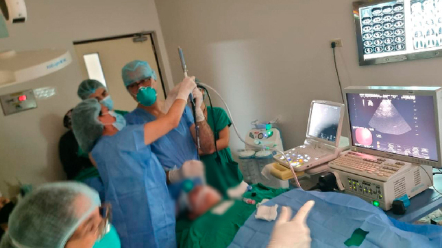 Realizamos primera biopsia por ultrasonografía endobronquial (EBUS -TBNA) 