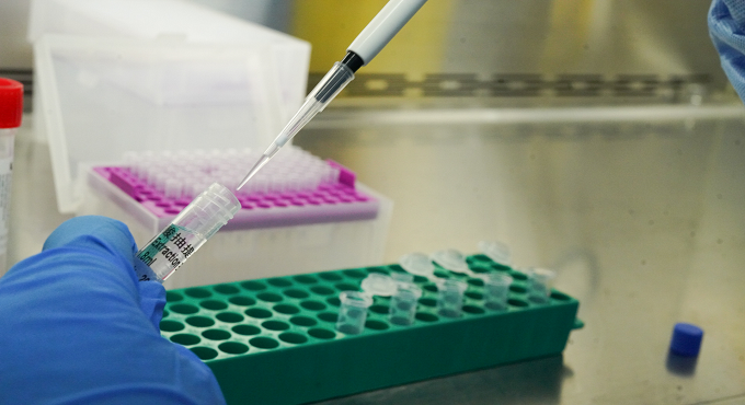 EsSalud refuerza vigilancia sanitaria y servicios ante alerta por Viruela Símica (Mpox)