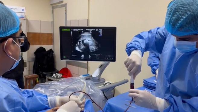 Médicos del Hospital Nacional Dos de Mayo salvan la vida al bebé de una gestante tras exitosa transfusión sanguínea fetal.