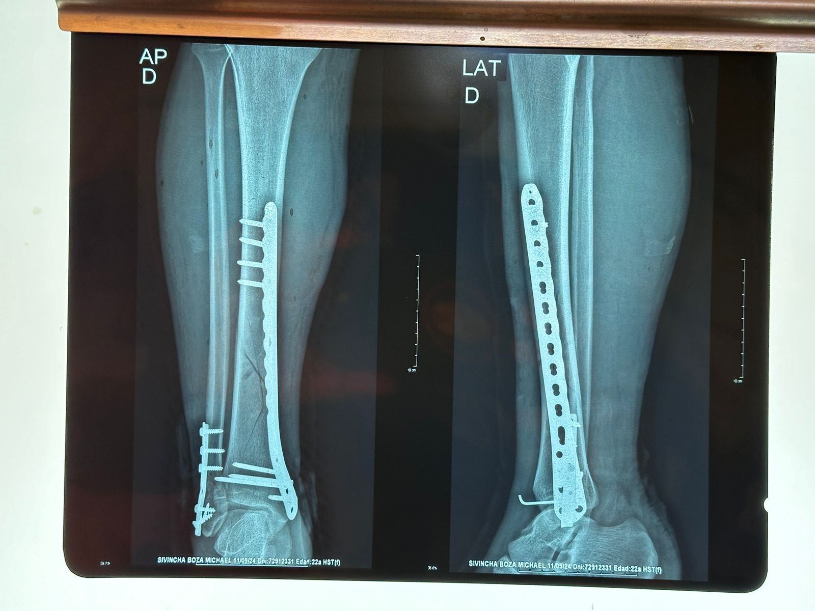 Servicio de Traumatología