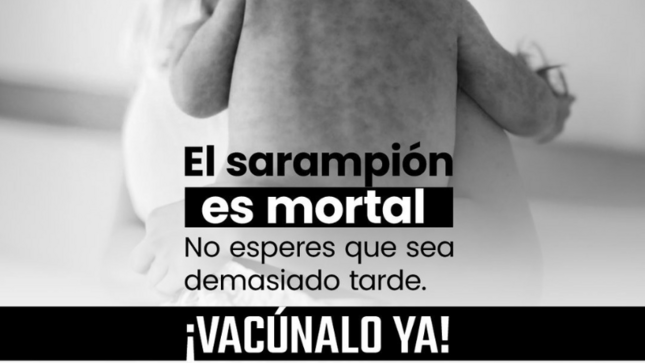 sarampion