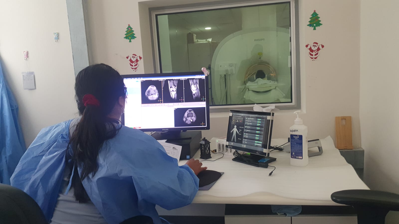 Se muestra el sistema de información radiológico