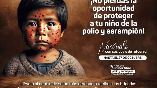 Comunicado con niño con sarampión al costado. 