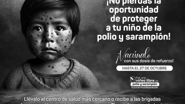 Comunicado con niño con sarampión al costado 