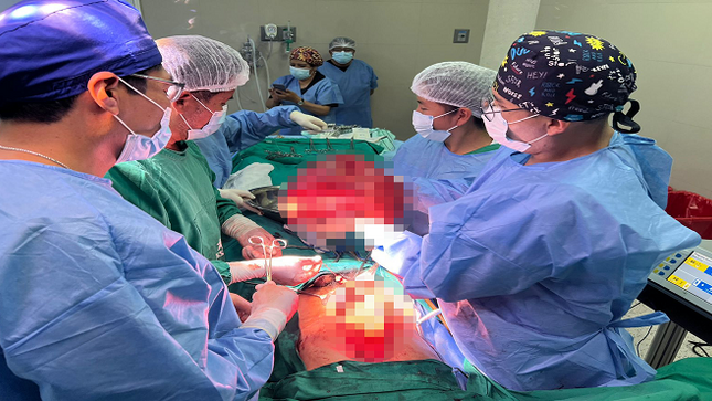 EsSalud: extirpan enorme tumor de más de 15 kilos a joven de 21 años en Puno