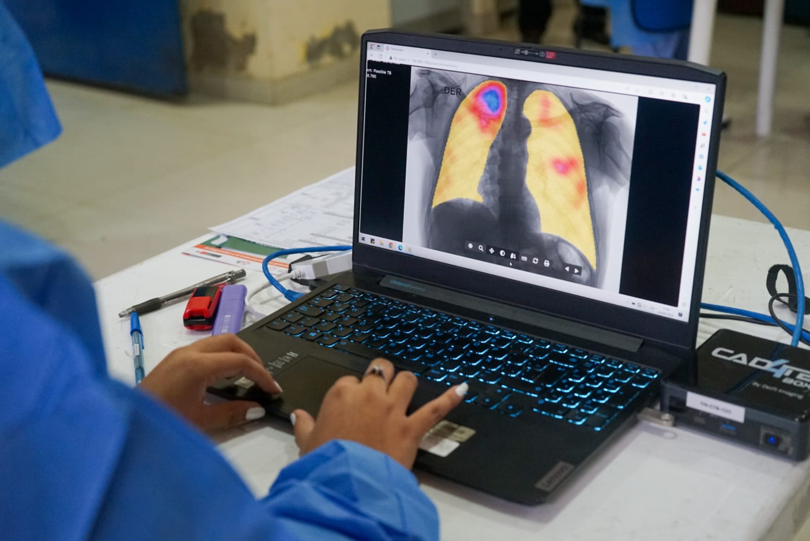 Perú da pasos significativos en la identificación temprana de casos y el tratamiento de la tuberculosis resistente