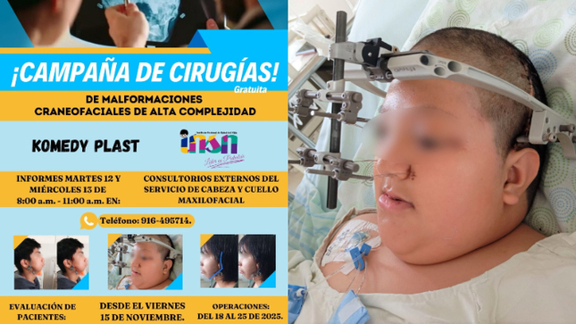 Cirujanos del INSN y médicos norteamericanos realizarán campaña de cirugías de malformaciones craneofaciales