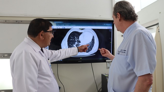 INEN: Solo el 20 % de los casos de cáncer de pulmón se diagnostican a tiempo