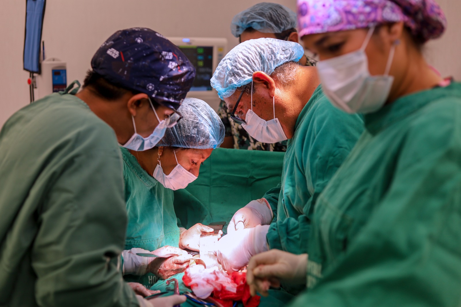 Cirujanos del hospital de Chulucanas extraen con éxito un tumor de 5 kilos del útero de una paciente
