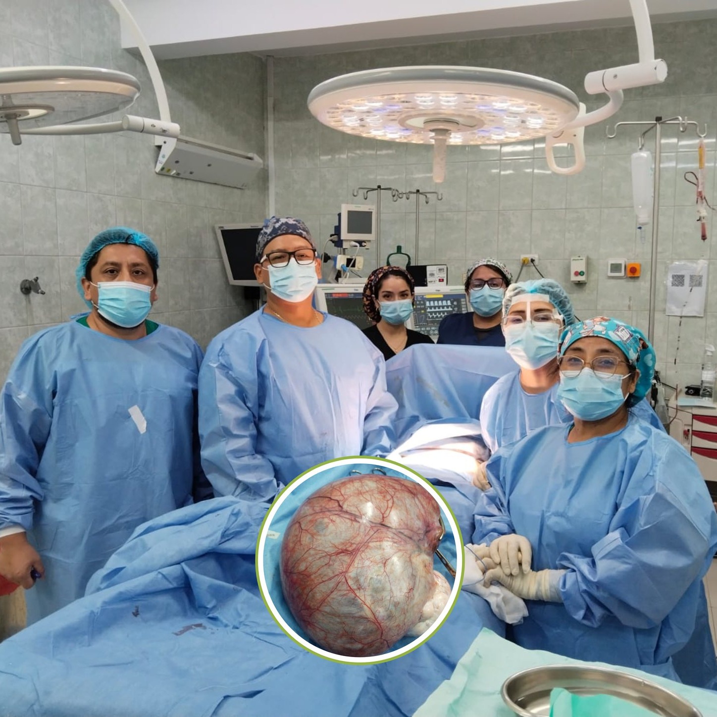 tumor2