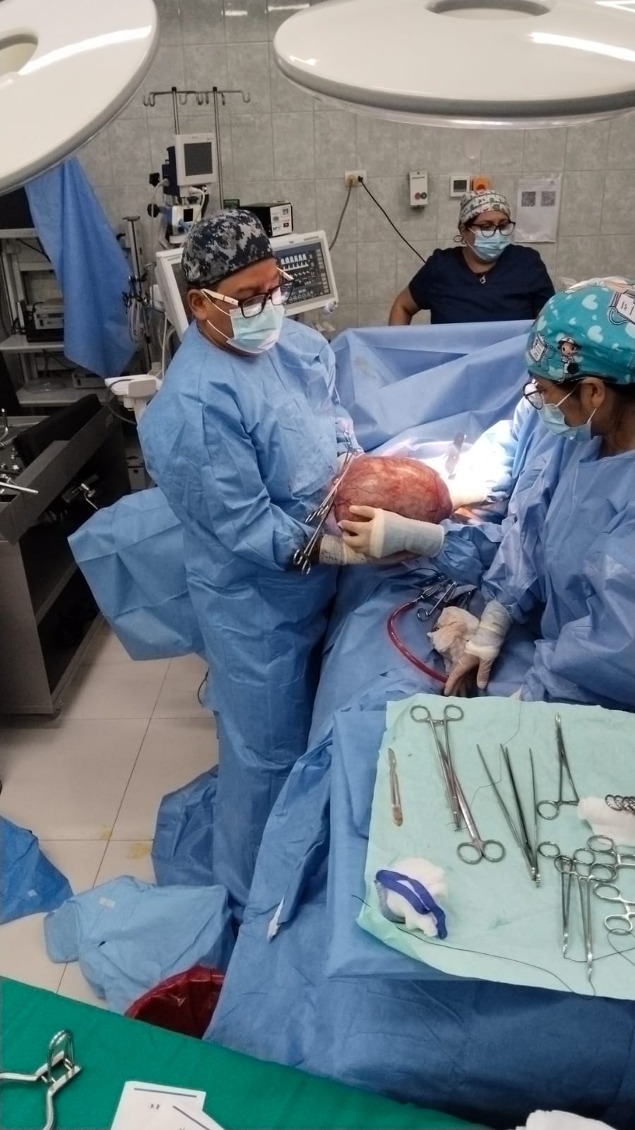 tumor3