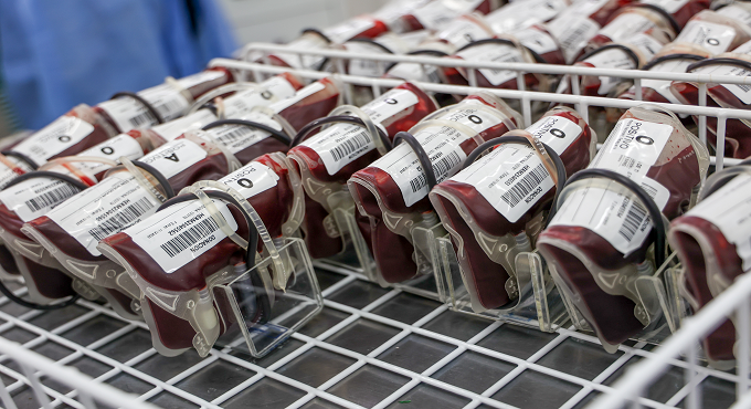 Hospital Rebagliati de EsSalud realizó más de 11 millones de pruebas de laboratorio de enero a noviembre de 2024