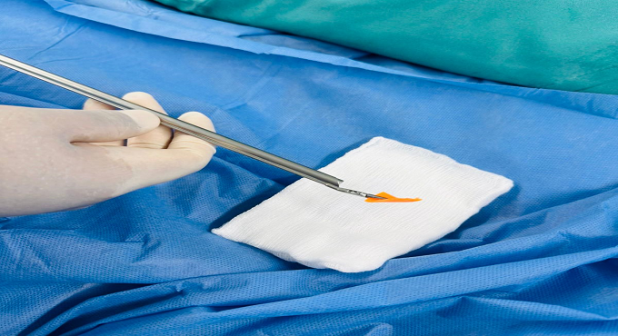 Médicos de EsSalud salvan la vida de dos bebés tras extraer un clavo de olor y un pedazo de plástico alojados en sus vías respiratorias