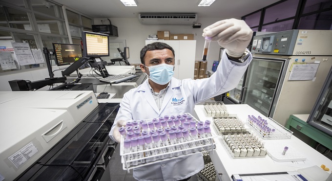 Hospital Rebagliati de EsSalud realizó más de 11 millones de pruebas de laboratorio de enero a noviembre de 2024