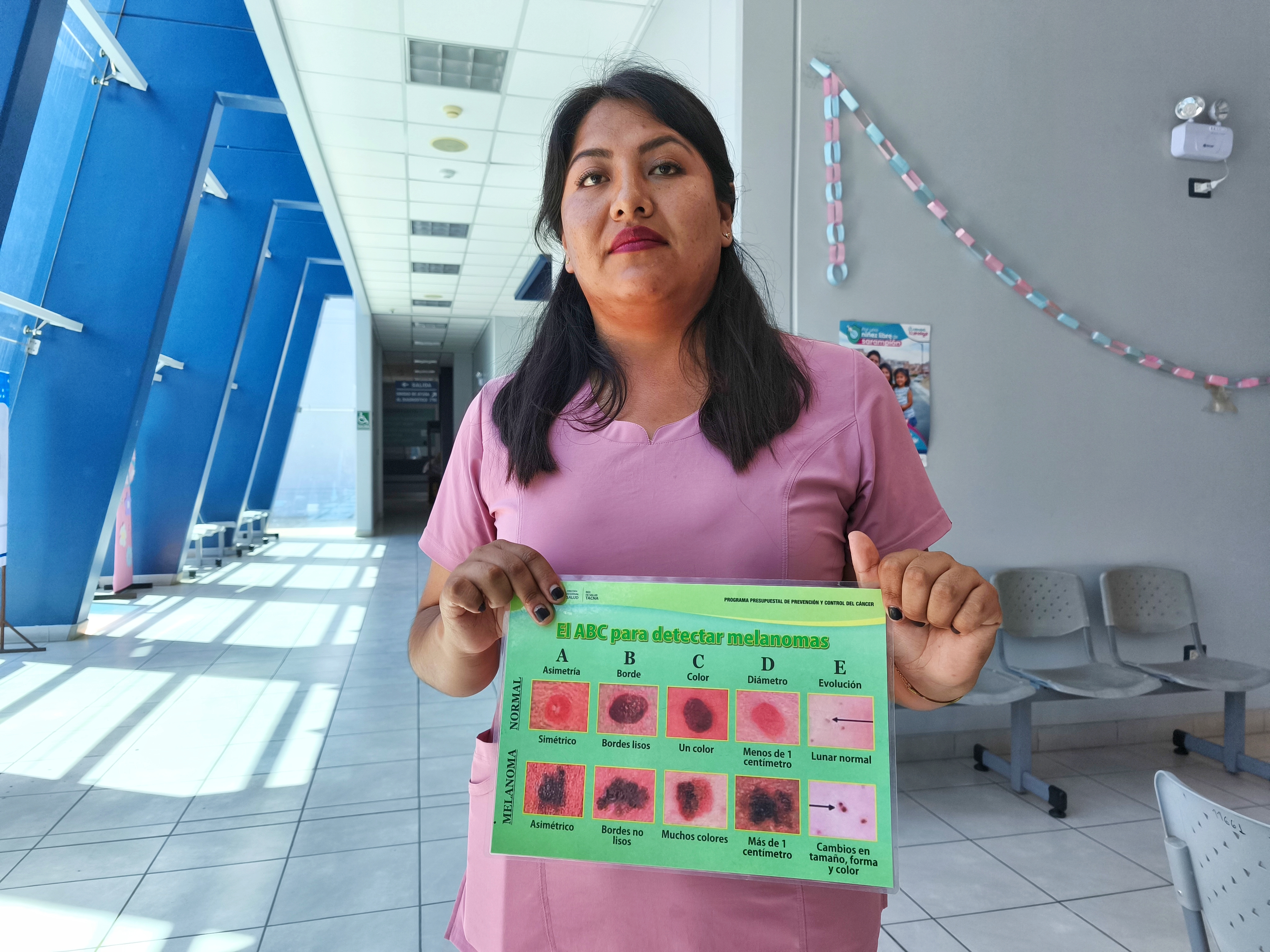 Diresa brinda recomendaciones para prevenir el cáncer en la piel
