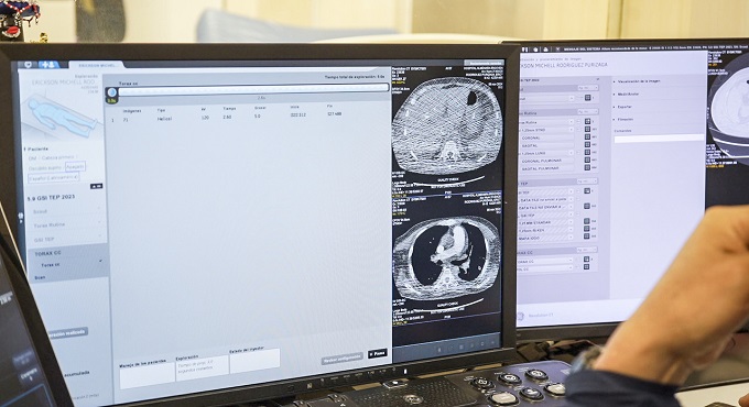 EsSalud Almenara realizó 189 mil tomografías en 2024, superando en un 50% la cifra del año anterior