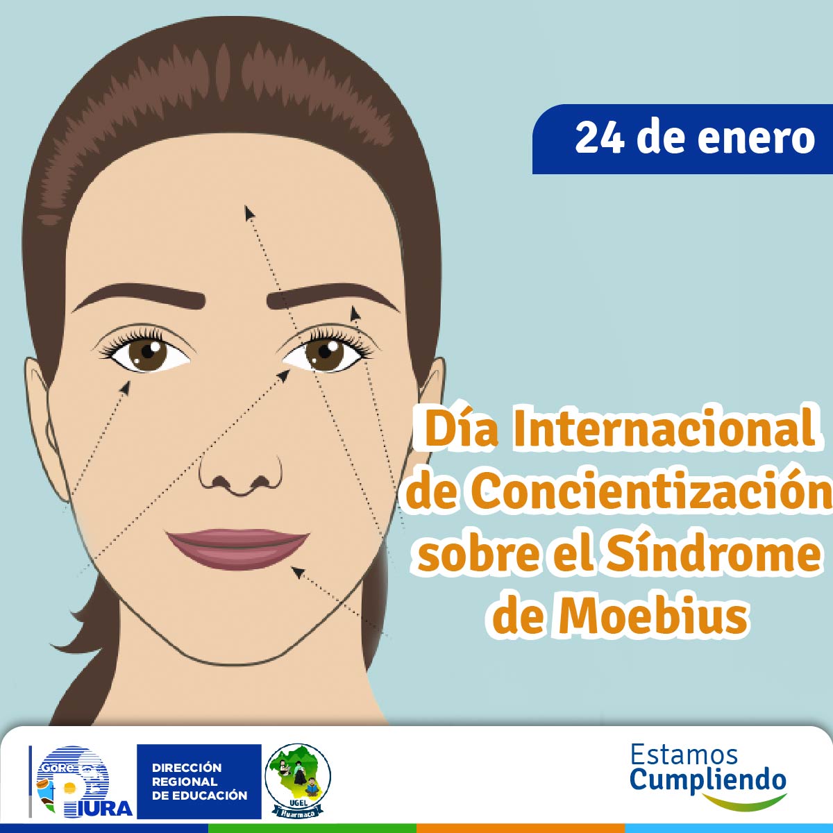 Esta enfermedad provoca parálisis o debilidad facial y puede provocar dificultades en el habla, la alimentación y la respiración, diferencias en las extremidades y otros síntomas. Es un trastorno congénito y no progresivo que afecta a personas de todos los ámbitos de la vida.
Fue descubierta en el año 1884 por el médico alemán Paul Julius Moebius, es considerada como una enfermedad rara. Consiste en la parálisis congénita de los músculos faciales y falta de movimiento en los ojos, ocasionado por el desarrollo parcial de los nervios craneales 6º y 7º. Incide también en otros nervios cerebrales que controlan funciones motoras, así como algunas malformaciones físicas en la lengua y otros miembros del cuerpo (manos y pies).