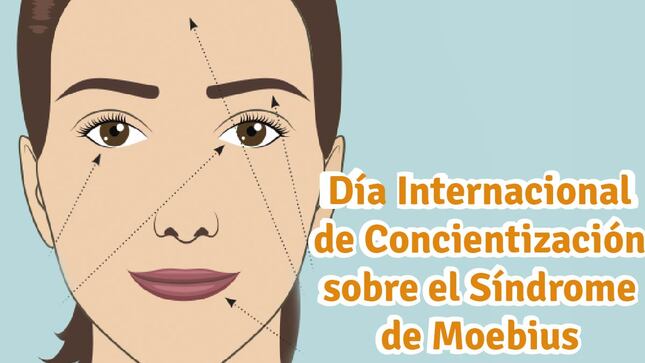 Esta enfermedad provoca parálisis o debilidad facial y puede provocar dificultades en el habla, la alimentación y la respiración, diferencias en las extremidades y otros síntomas. Es un trastorno congénito y no progresivo que afecta a personas de todos los ámbitos de la vida. 
 
Fue descubierta en el año 1884 por el médico alemán Paul Julius Moebius, es considerada como una enfermedad rara. Consiste en la parálisis congénita de los músculos faciales y falta de movimiento en los ojos, ocasionado por el desarrollo parcial de los nervios craneales 6º y 7º. Incide también en otros nervios cerebrales que controlan funciones motoras, así como algunas malformaciones físicas en la lengua y otros miembros del cuerpo (manos y pies).