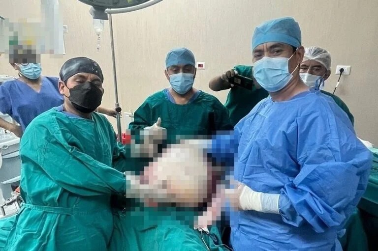 Médicos del Hospital Hermilio Valdizán extirpan tumor cerebral de 80 centímetros a paciente de 60 años