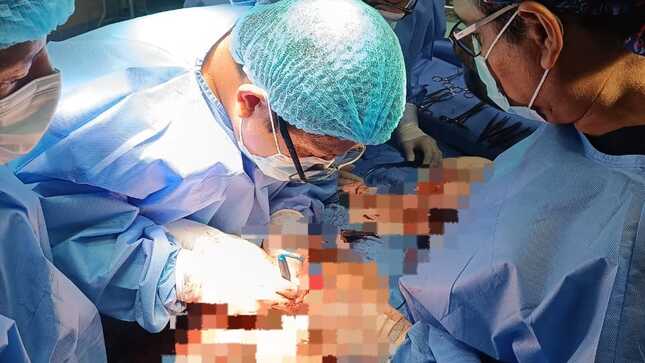 tumor 3.5 kilogramos